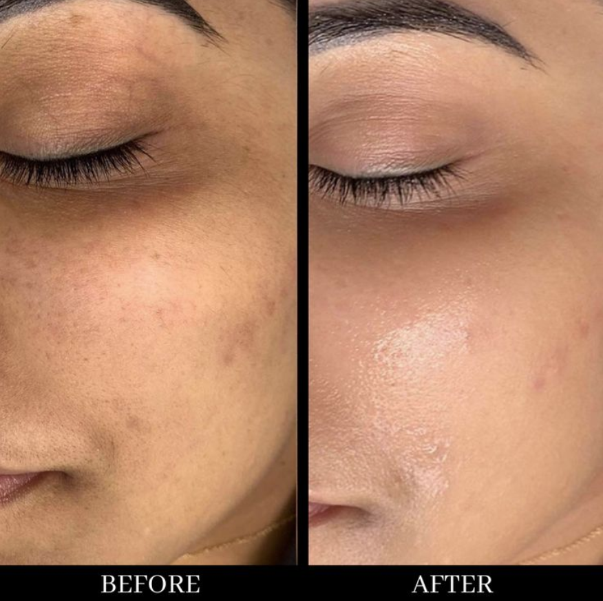 bb glow avant/après