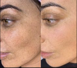 bb glow avant/après